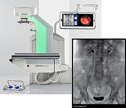 Siemens UROSKOP Omnia - KUB tract