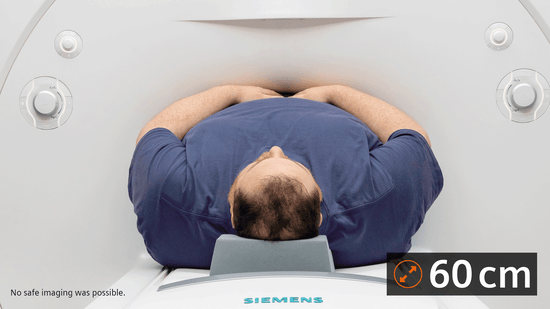 Featured image for Siemens Healthineers collaborating on world’s first carbon-neutral radiology imaging service