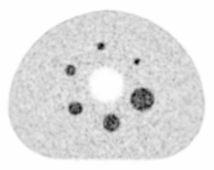 BiographXLesion