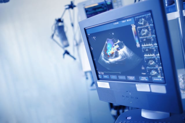 The Surprising Way AI Is Reshaping Cardiac Ultrasound