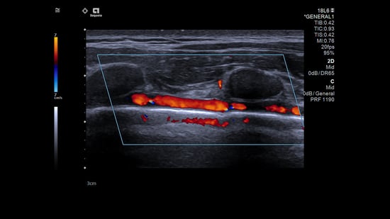 Featured image for Ultrasound in the Age of COVID-19