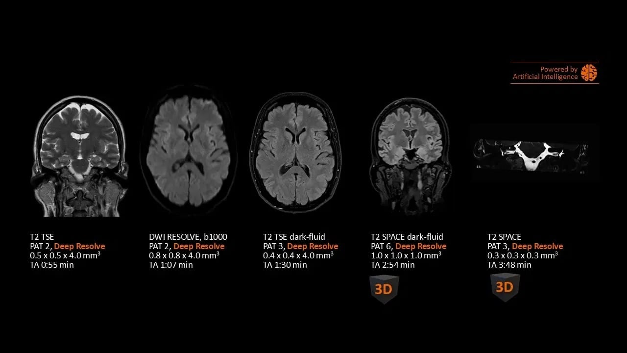 MAGNETOM Flow. Platform Head