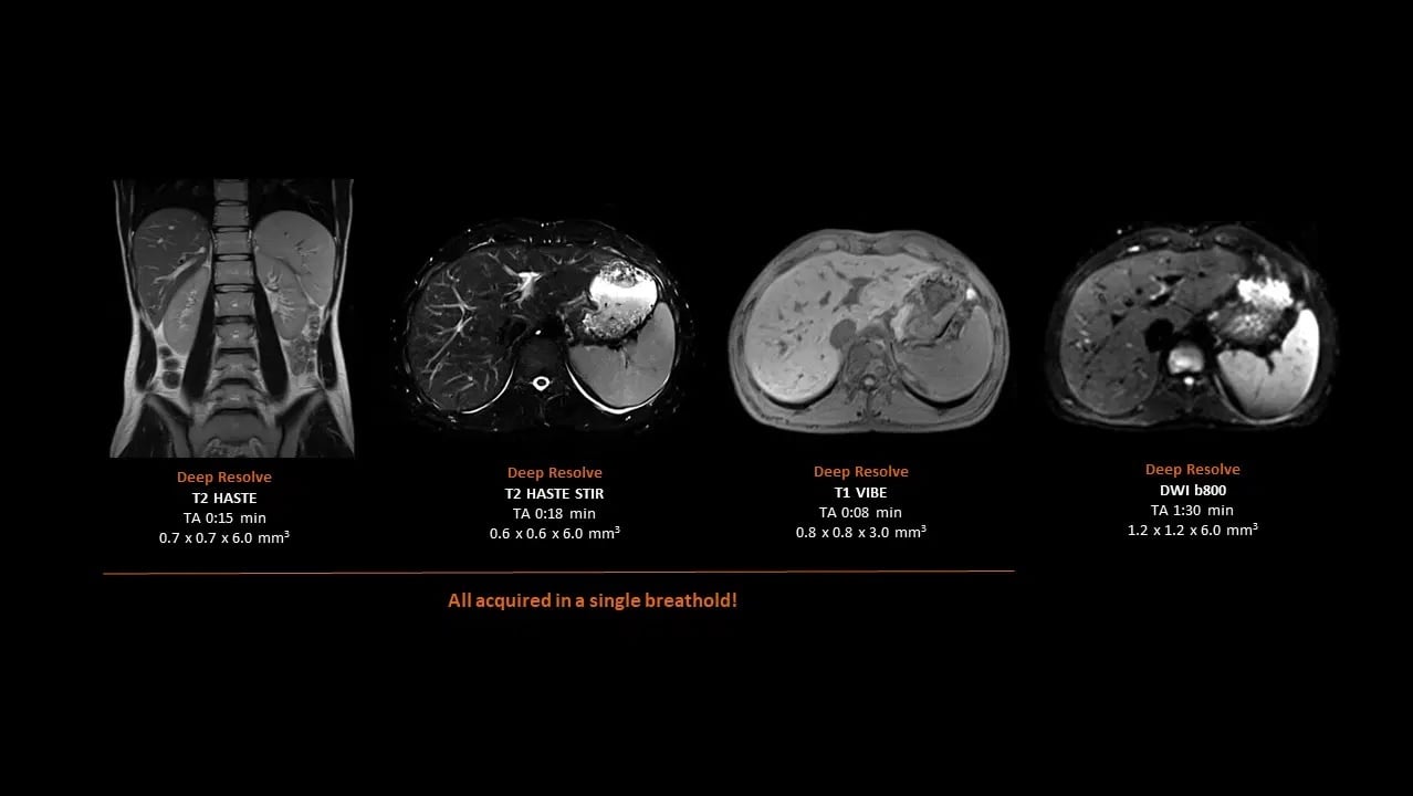 MAGNETOM Flow. Platform Liver