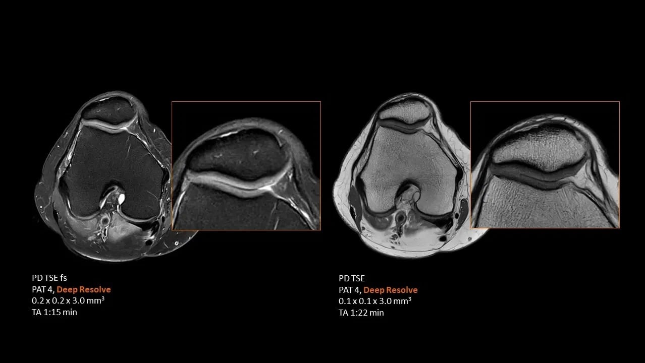 MAGNETOM Flow. Platform MSK
