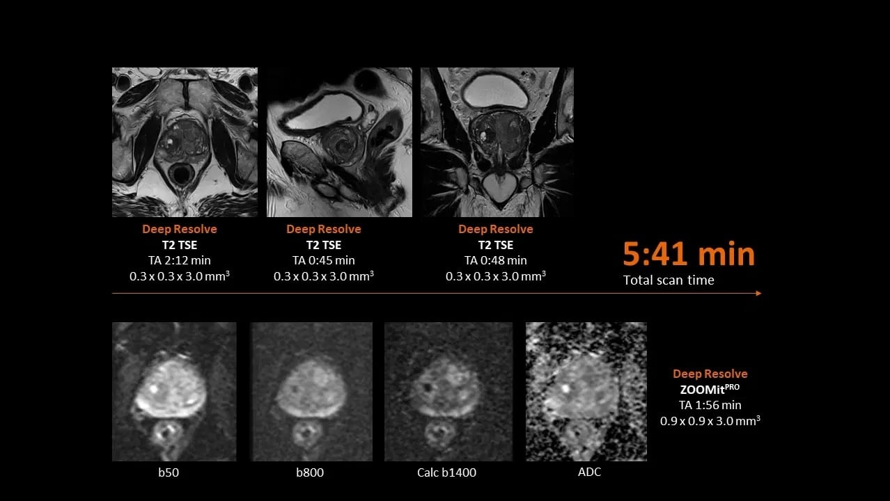 MAGNETOM Flow. Platform Prostate