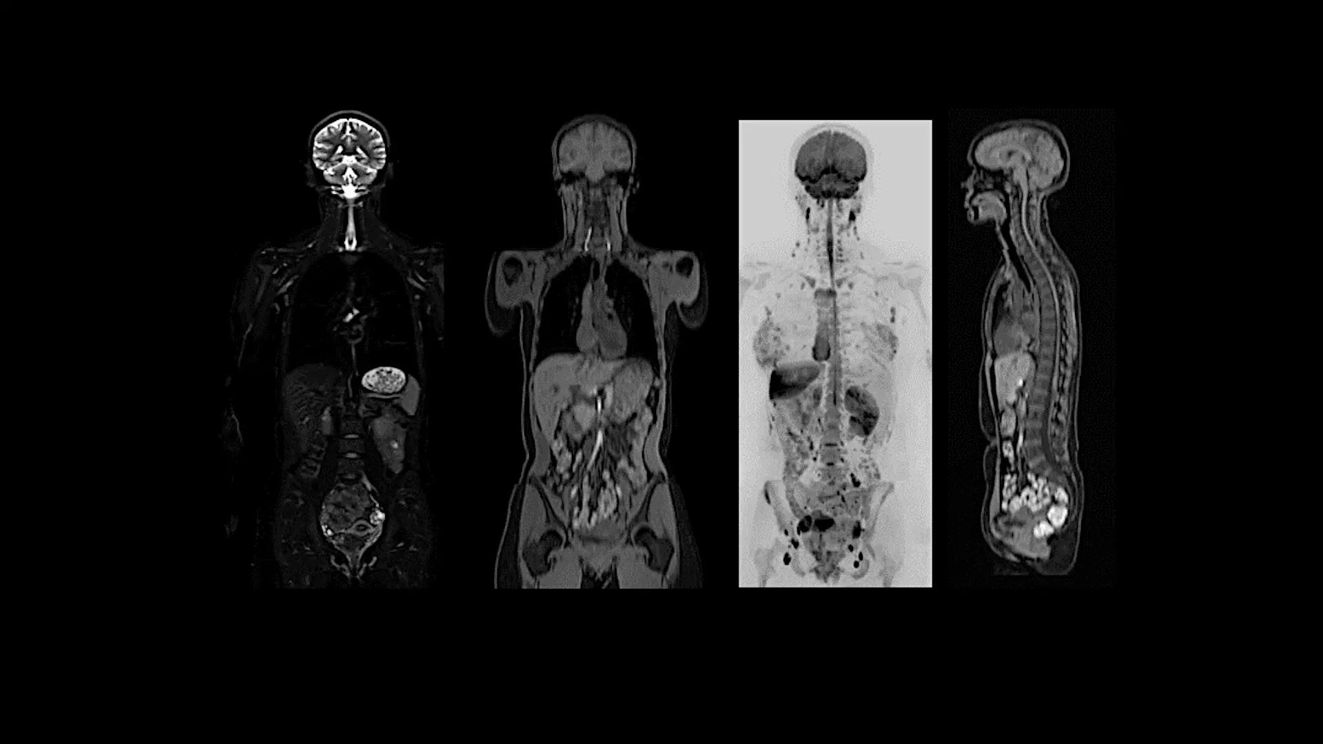 MAGNETOM Flow. Platform Whole Body