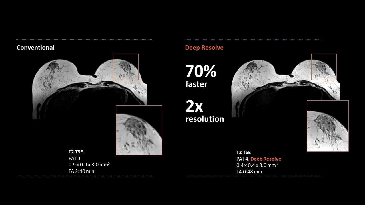 MAGNETOM Flow. Platform Womens Health