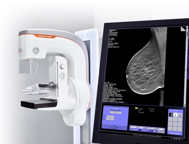 3D Breast Tomosynthesis ROI Calculator