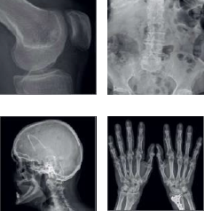 Sharp-clinical-images