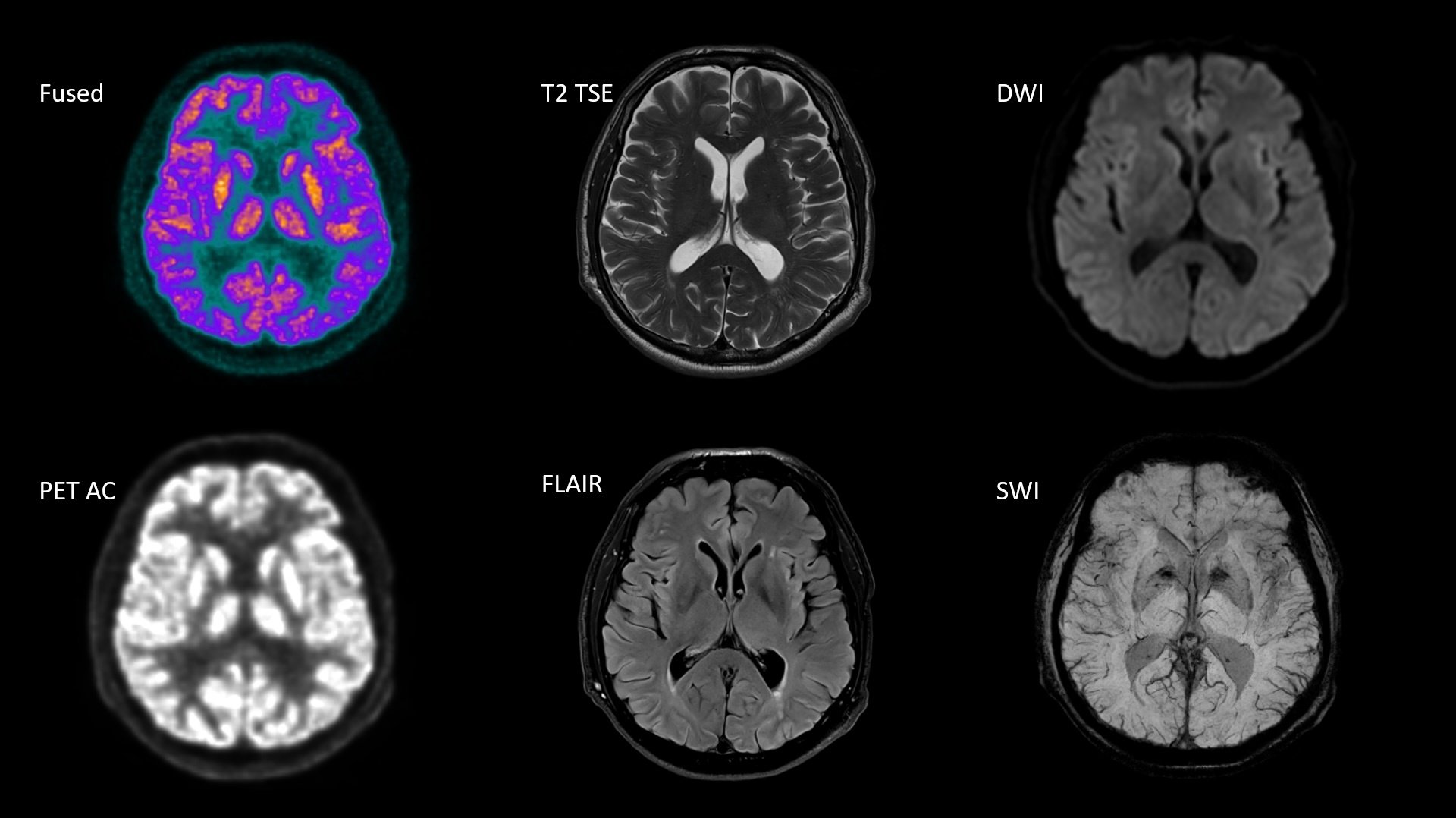 BIOGRAPH One Evidence - Diagnosis and Staging