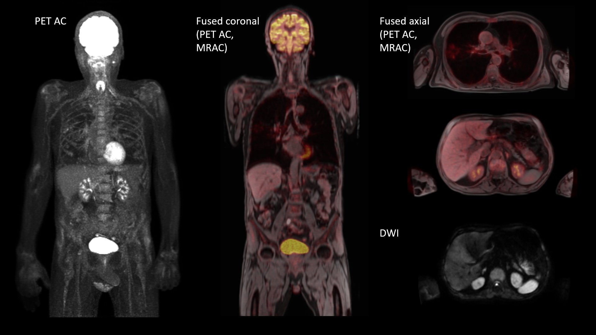 BIOGRAPH One Evidence - Therapy assessment
