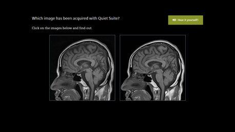 siemens-mri-amira_quietsuite