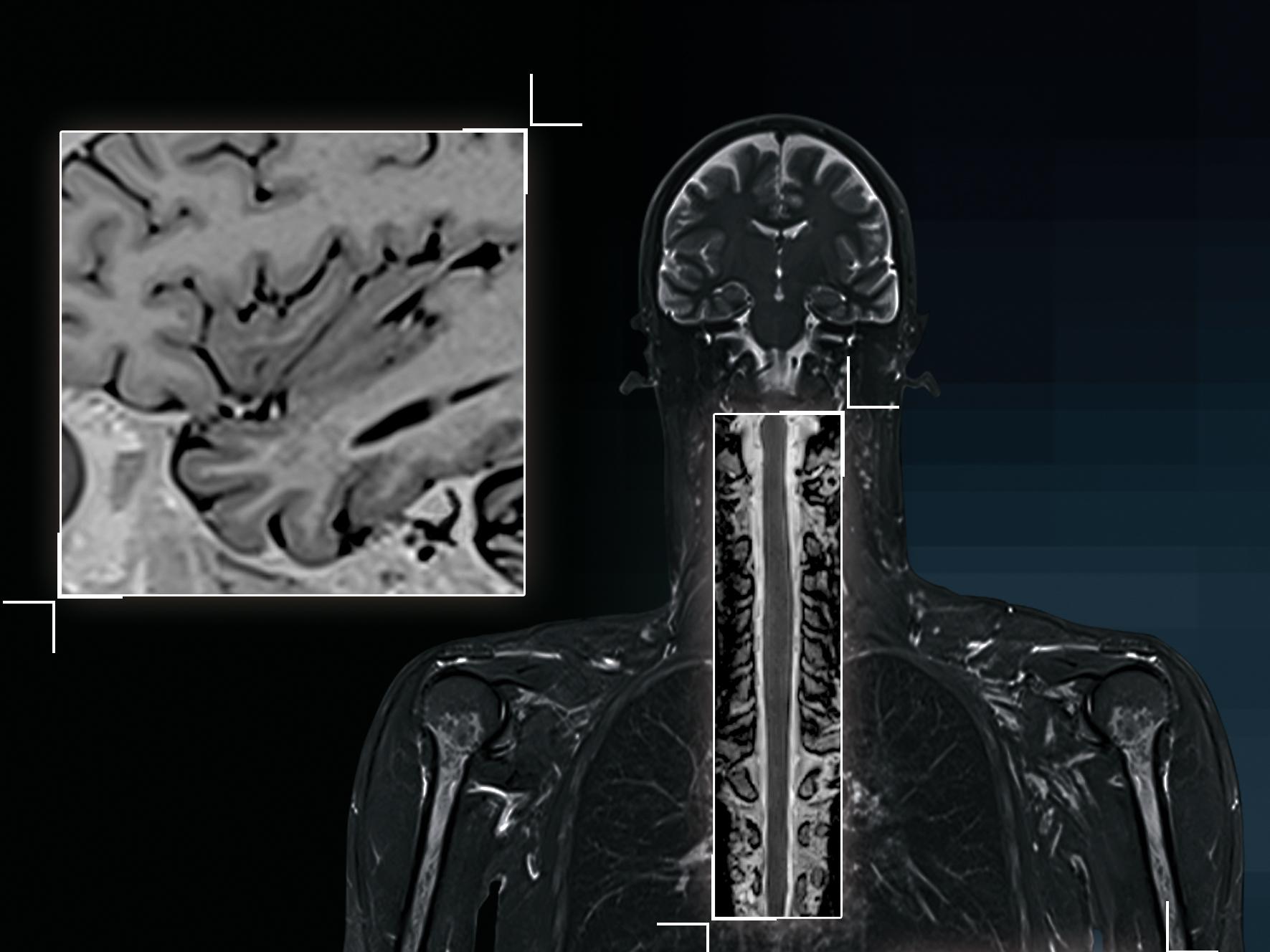 MRI-TimTX_TrueShape_1800000000114880