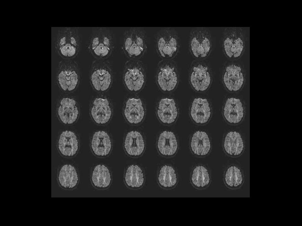 mri-magentom-prisma-research_000101_1800000000275256
