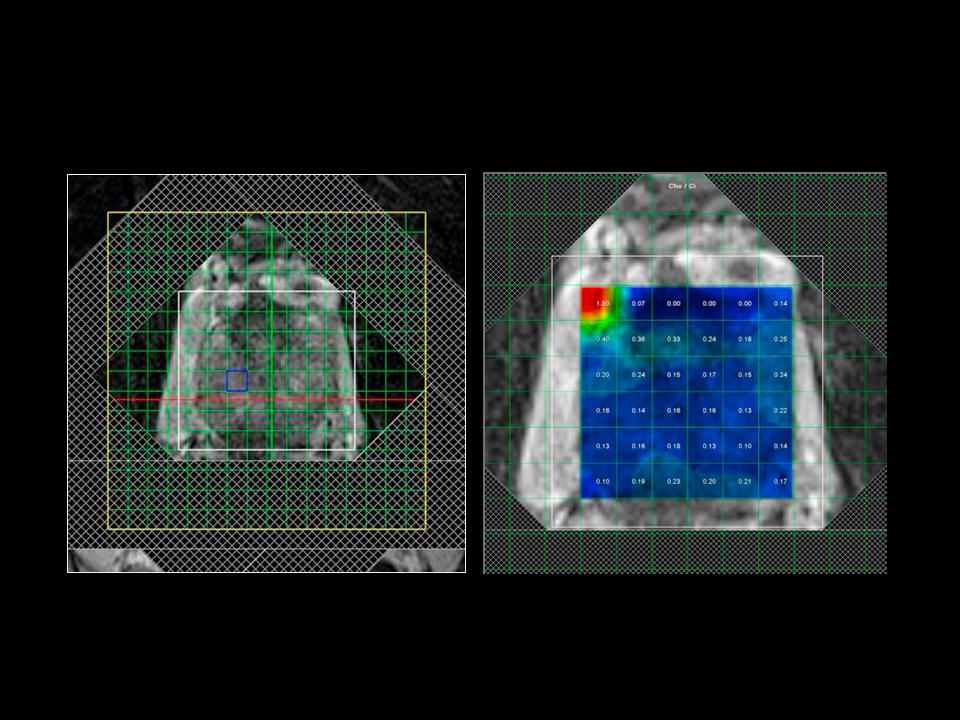 mri-magentom-prisma-research_000103_1800000000275254