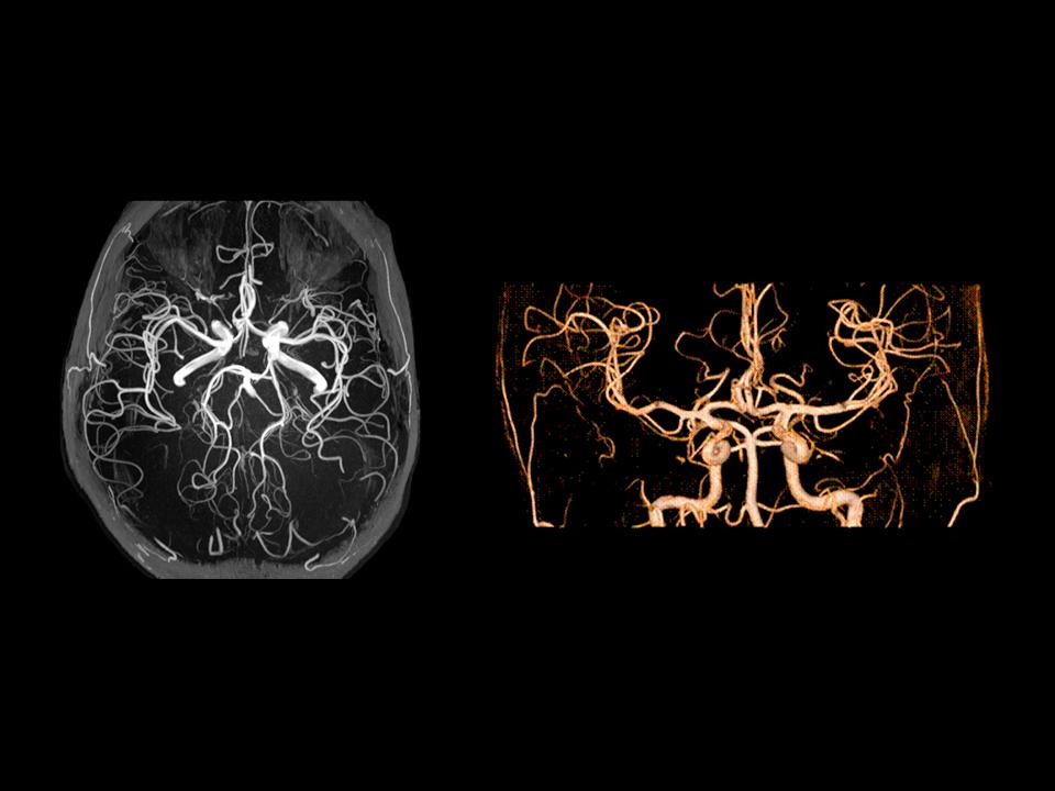 mri-magentom-prisma-research_000104_1800000000275253