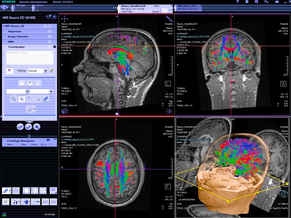 mri-magentom-prisma-research_000107_1800000000275251