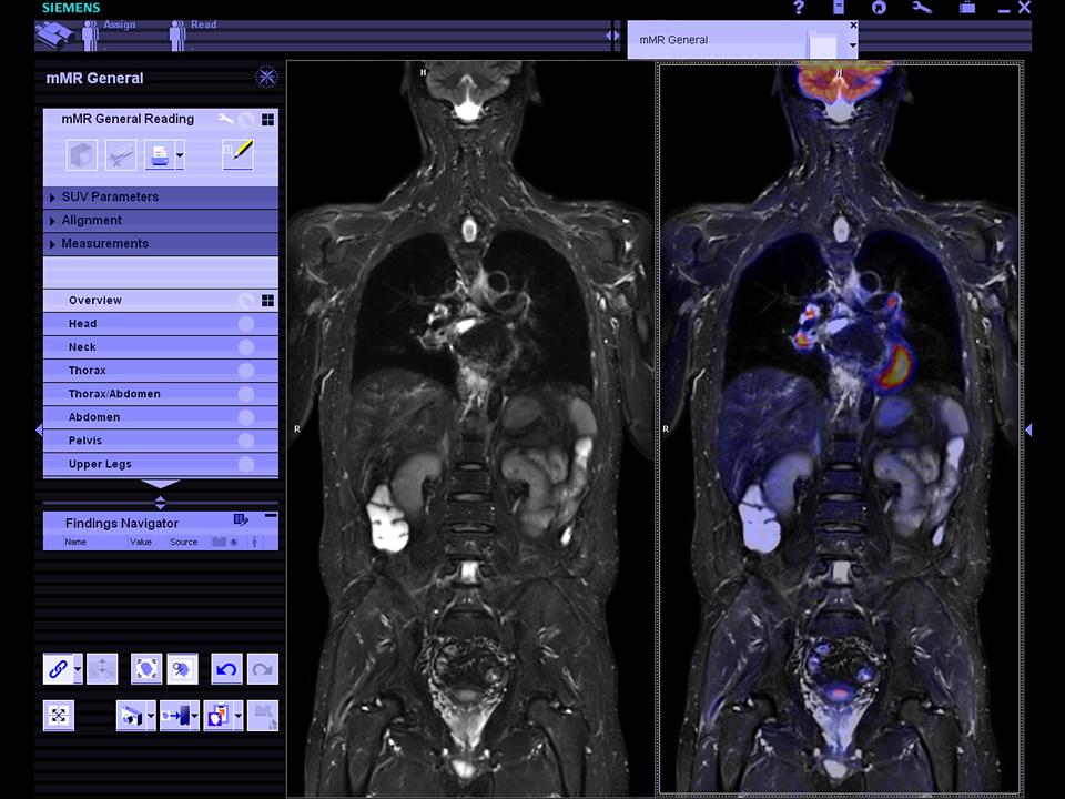 MRI-Biograph-mMR-Clinical-syngommr_1800000000180471