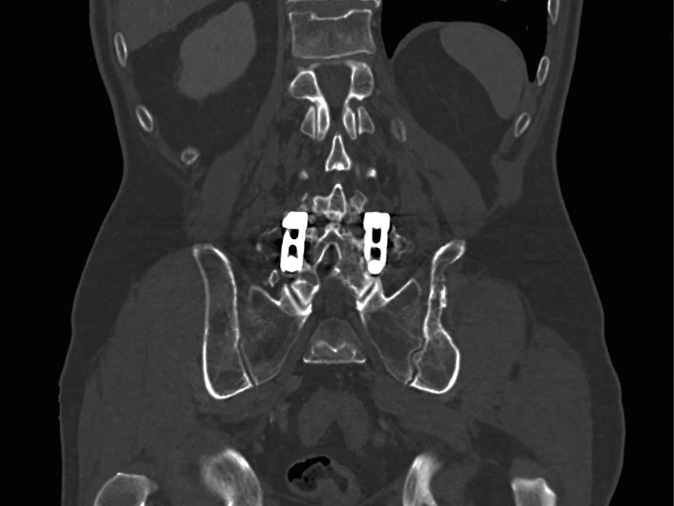 Siemens-Healthineers_CT_SOMATOM-go-Up_clinicalroutine_ct-scanner_1800000003530803