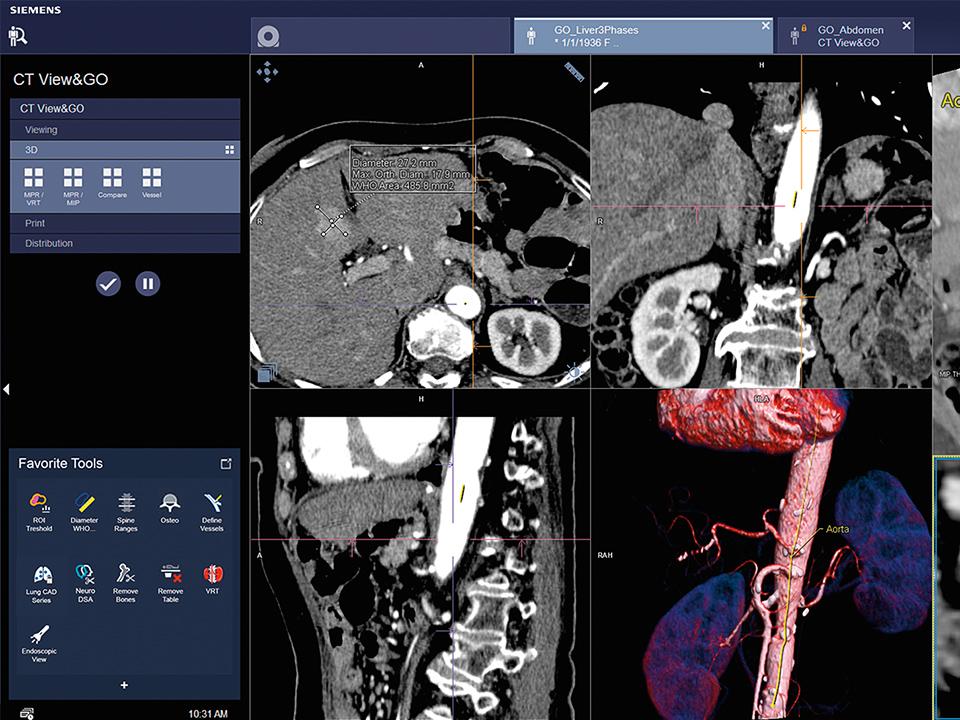 Siemens-Healthineers_CT_SOMATOM-go-Up_ctviewandgo_ct-scanner_1800000003530816