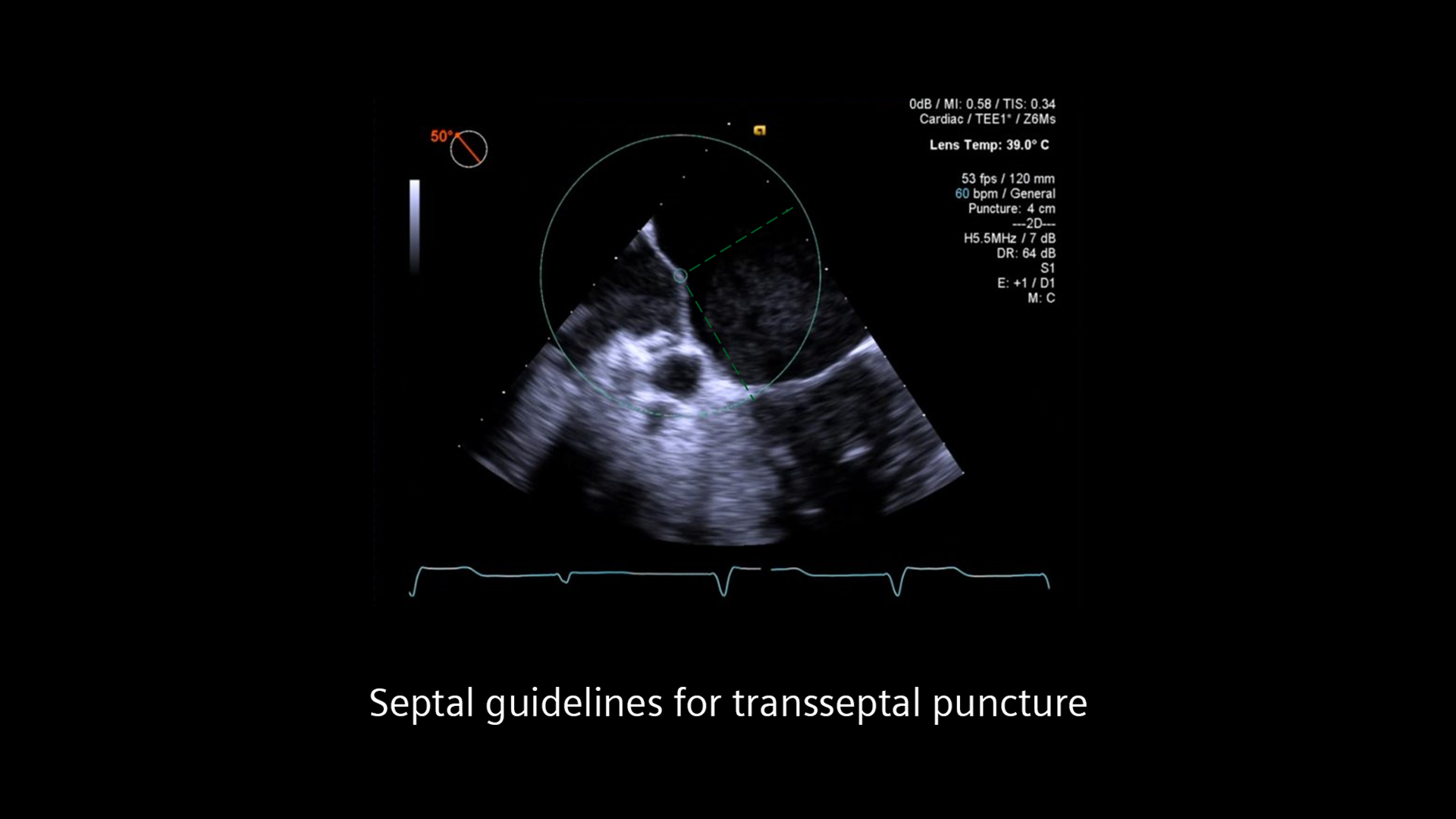 8_Septal-Guidelines