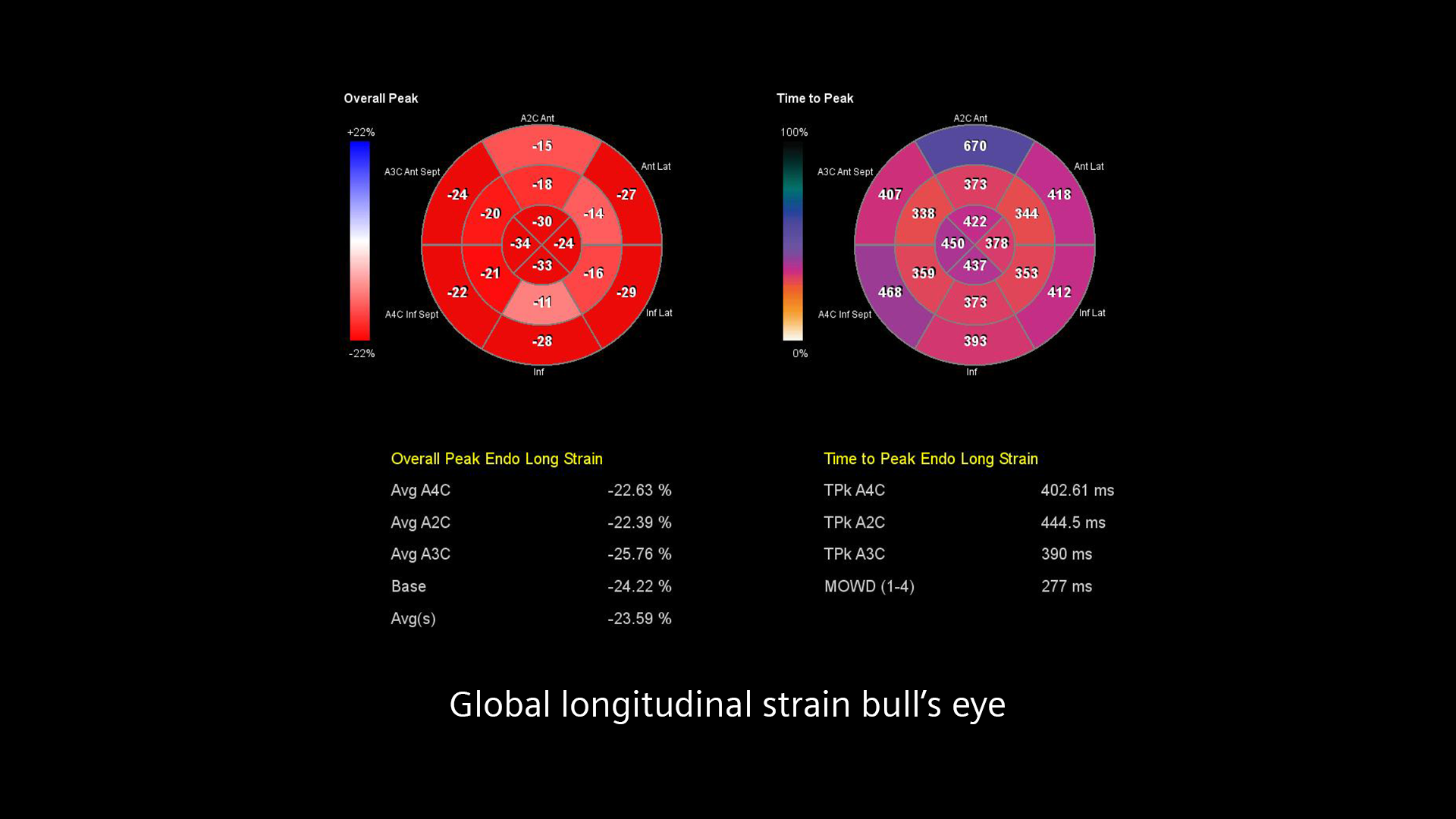Global-strain-bull-s-eye