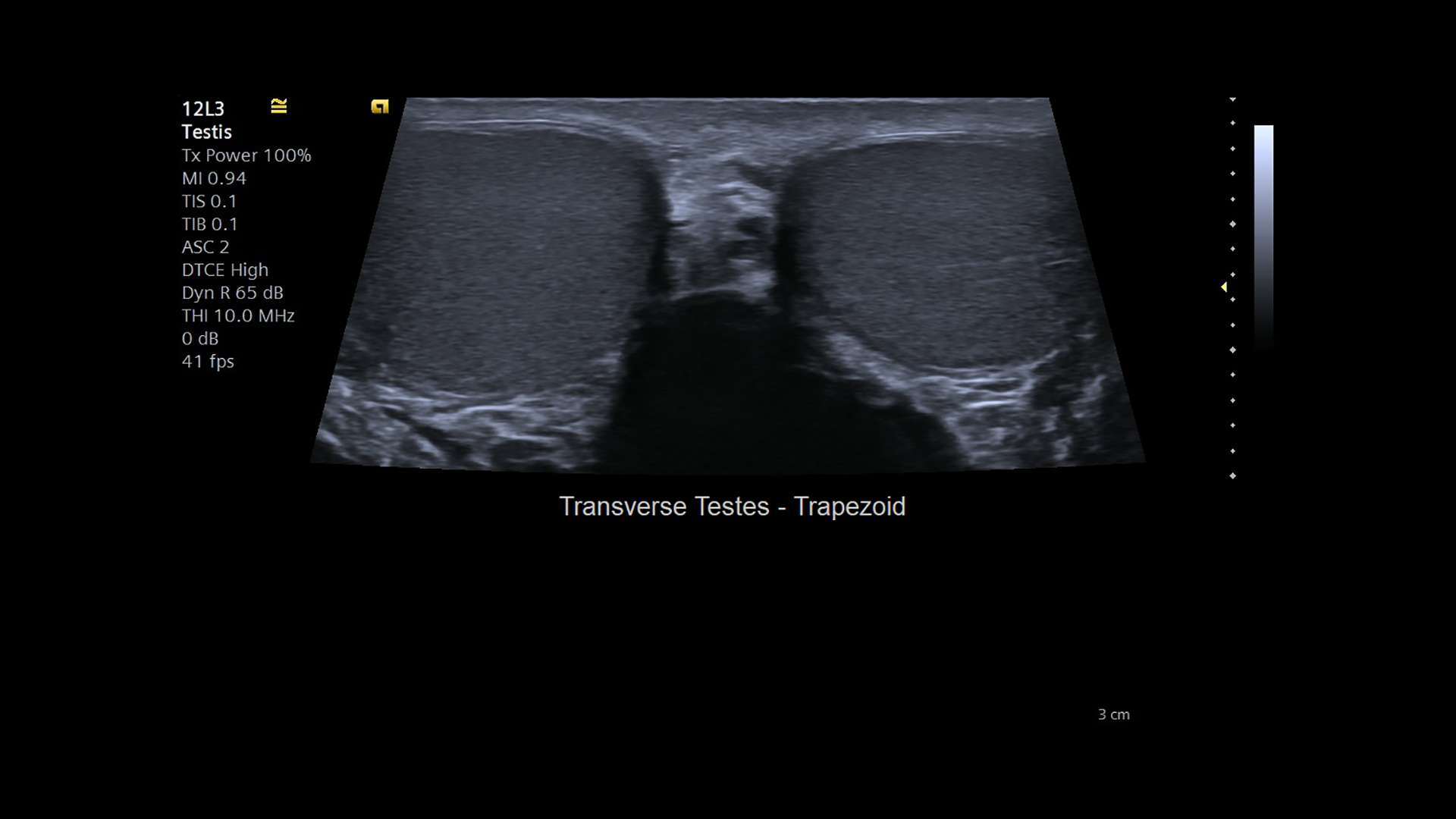 10-12L3TransTrapezTestes1-HOOD05162002829264