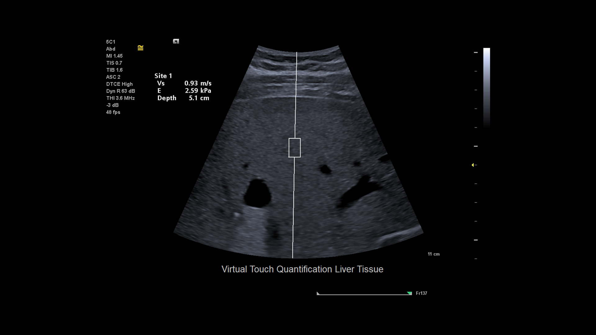 5-5C1VirtualTouchQuantification-HOOD05162002829264