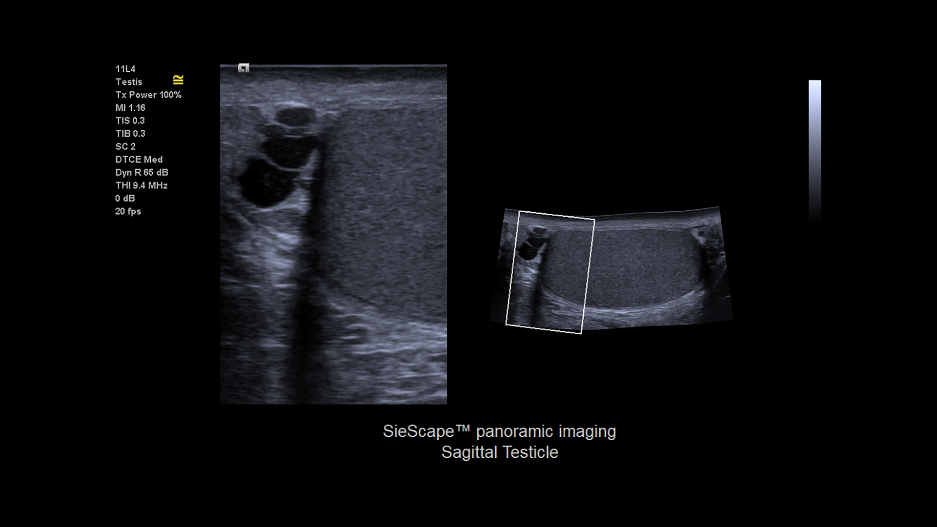 ACUSON Juniper is a High-Performance Shared Service Ultrasound System. -  Siemens Healthineers