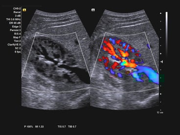 Hemodynamics webinar main intro image