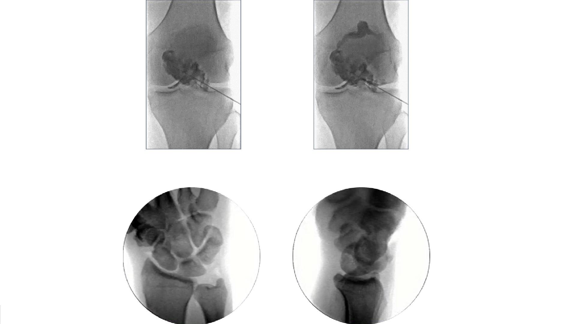 sh-multinom-rax-comprehensive-diagnosis-fluoroscopy-and-interventions