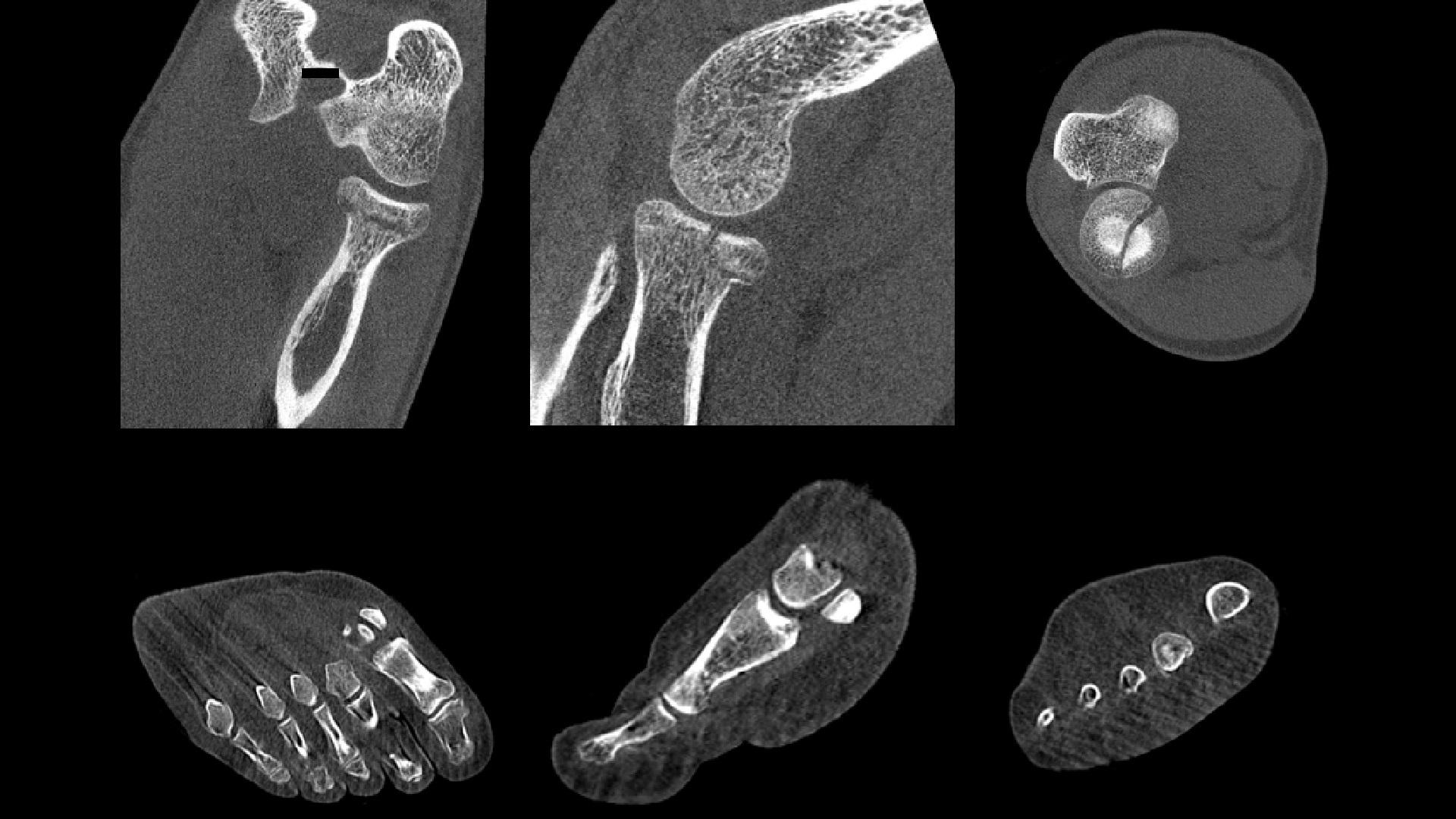 sh-multinom-rax-comprehensive-diagnosis-real-3d-extremities-lying2