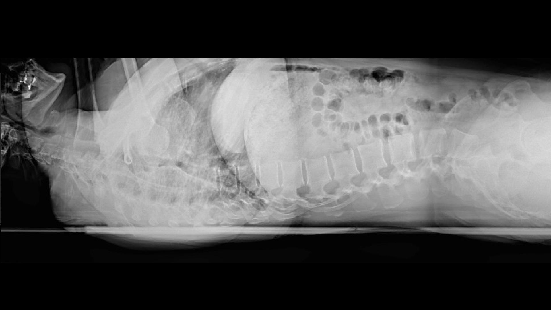 sh-multinom-rax-precise-insights-cross-table-smart-ortho-lateral