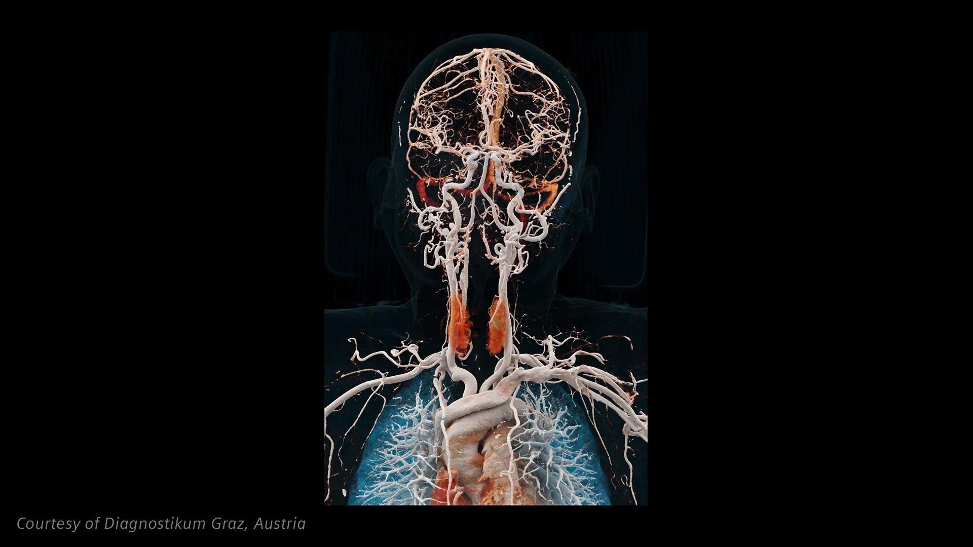 NAEOTOM Alpha.Prime Neurology