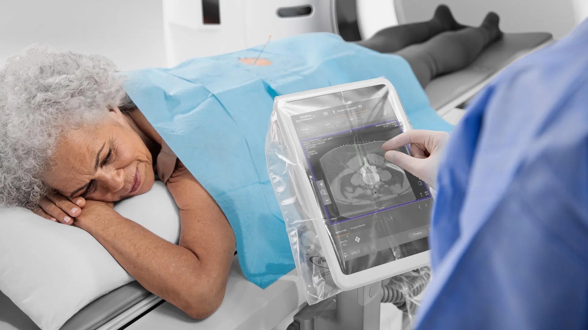 NAEOTOM Alpha.PrimeOncology