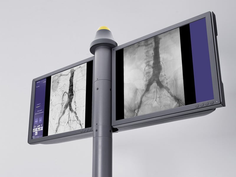 mobile-c-arm-cios-alpha-retina-imaging-chain-01176854-10-800px