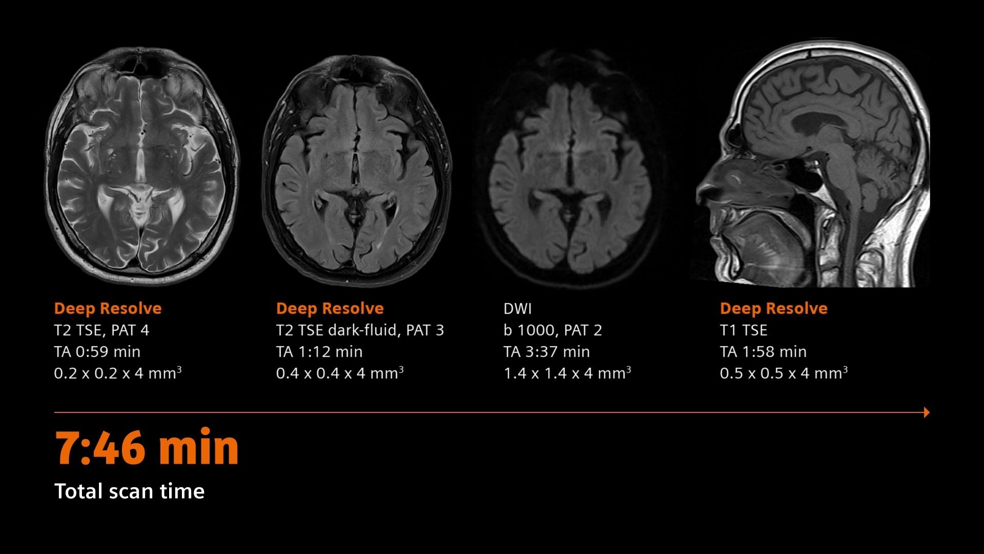 siemens-healthineers-DI_MRI_MAGNETOM-Flow-Ace_Head-Neuro-Biomatrix