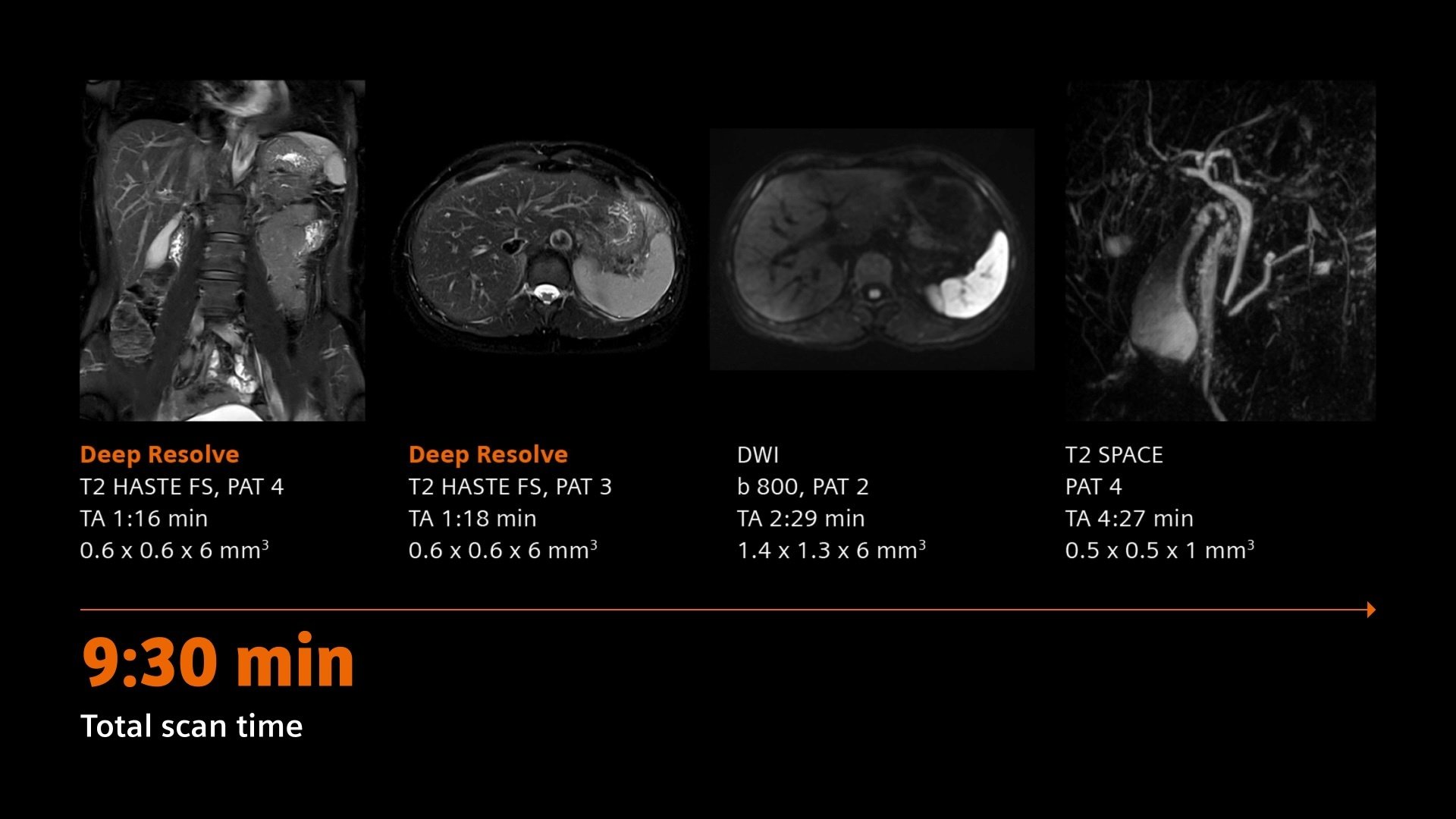 siemens-healthineers-DI_MRI_MAGNETOM-Flow-Ace_Liver-imaging-BioMatrix