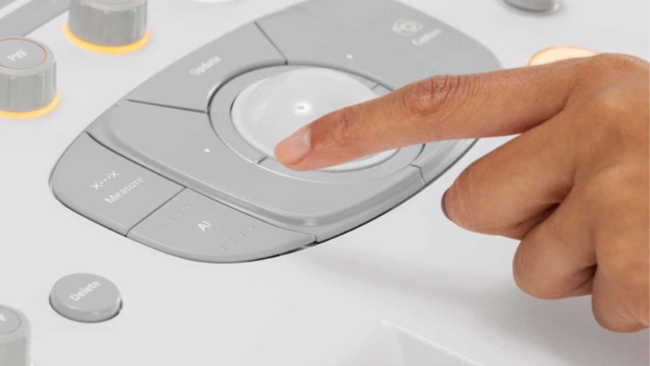 siemens-healthineers-us-acuson-origin-ai-button
