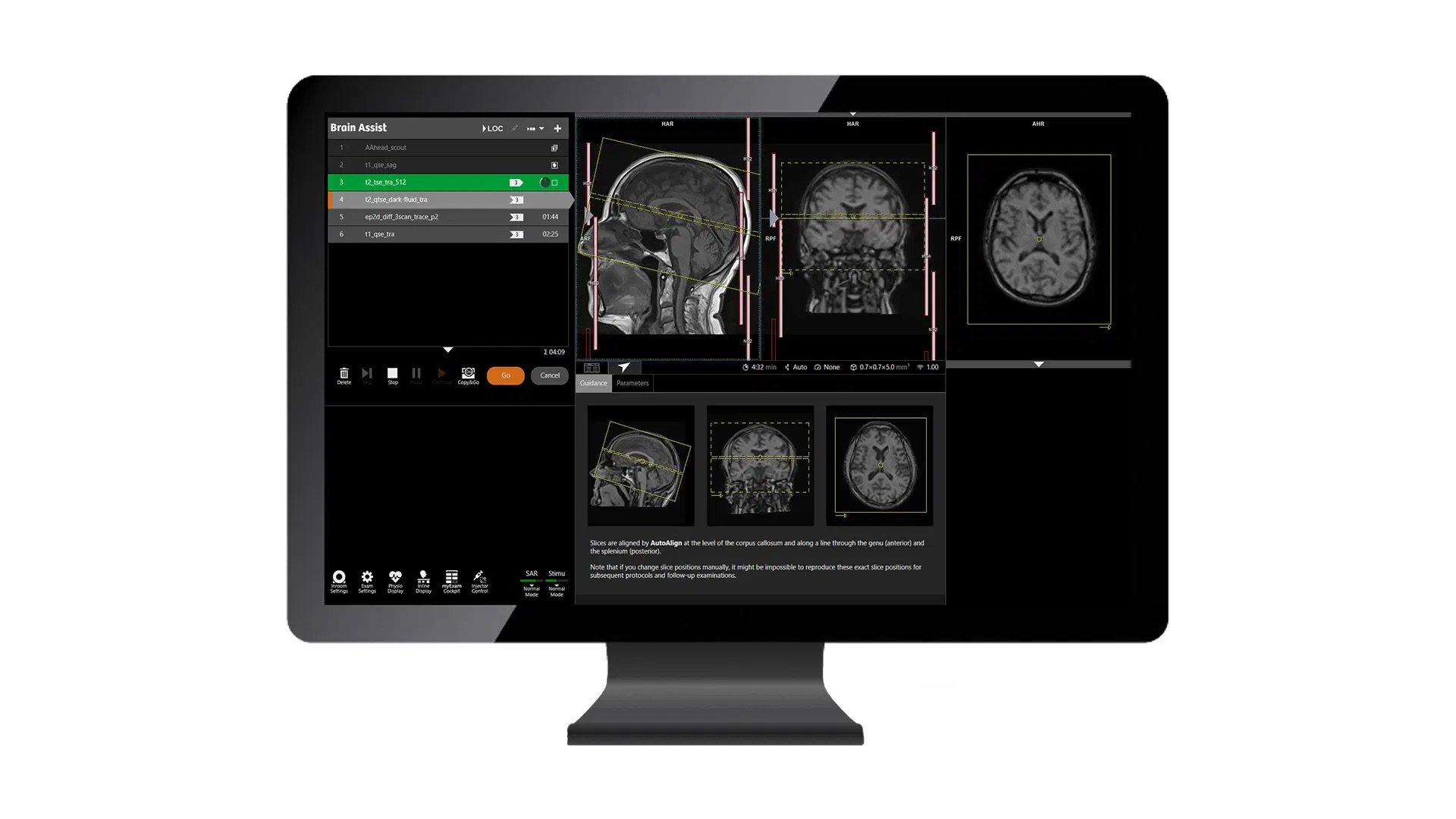 siemens-healthineers_DI-MR_Brain-Assist