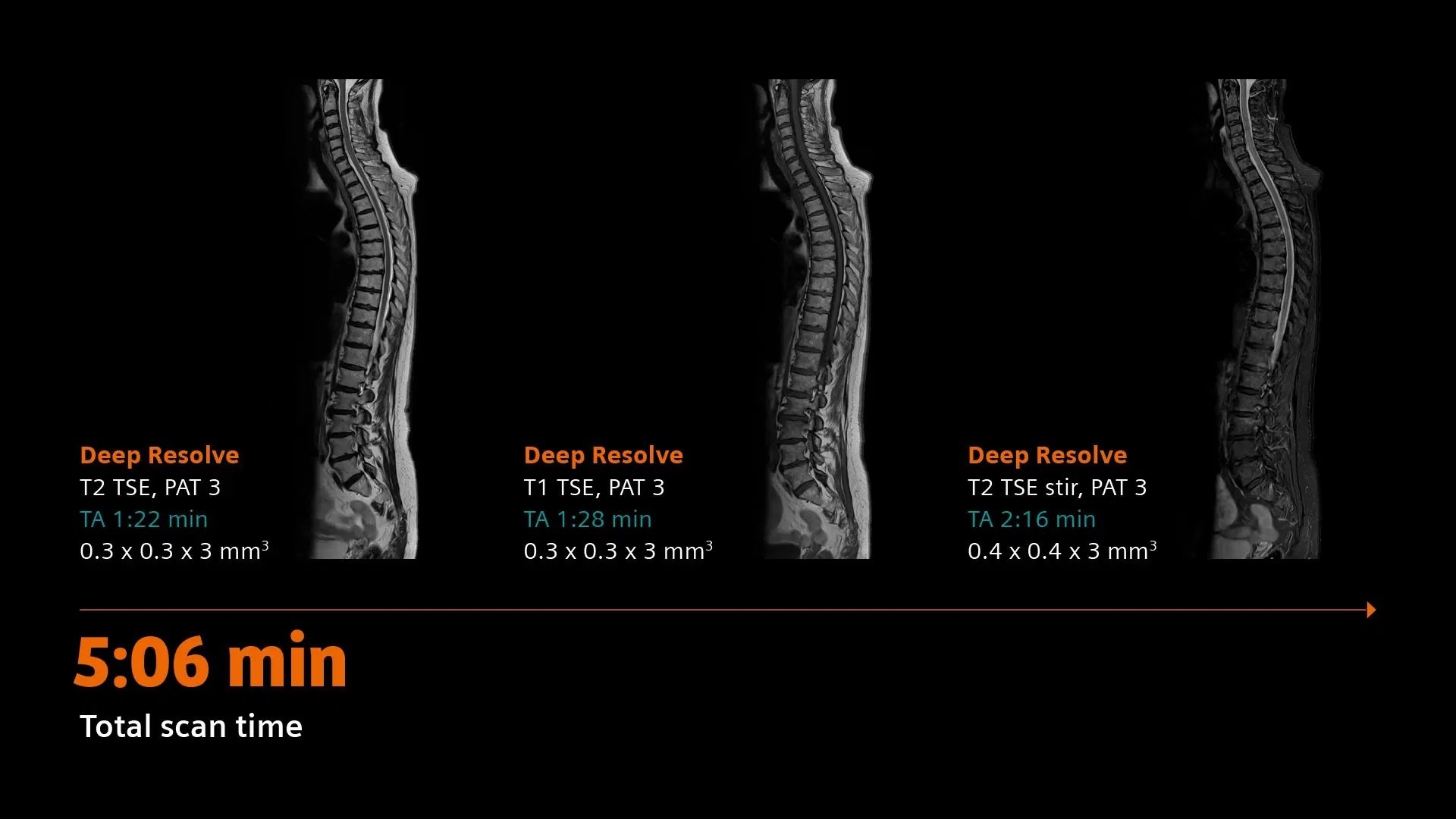 siemens-healthineers_DI_MRI_MAGNETOM-Flow_03_Spine-Fast-Scan
