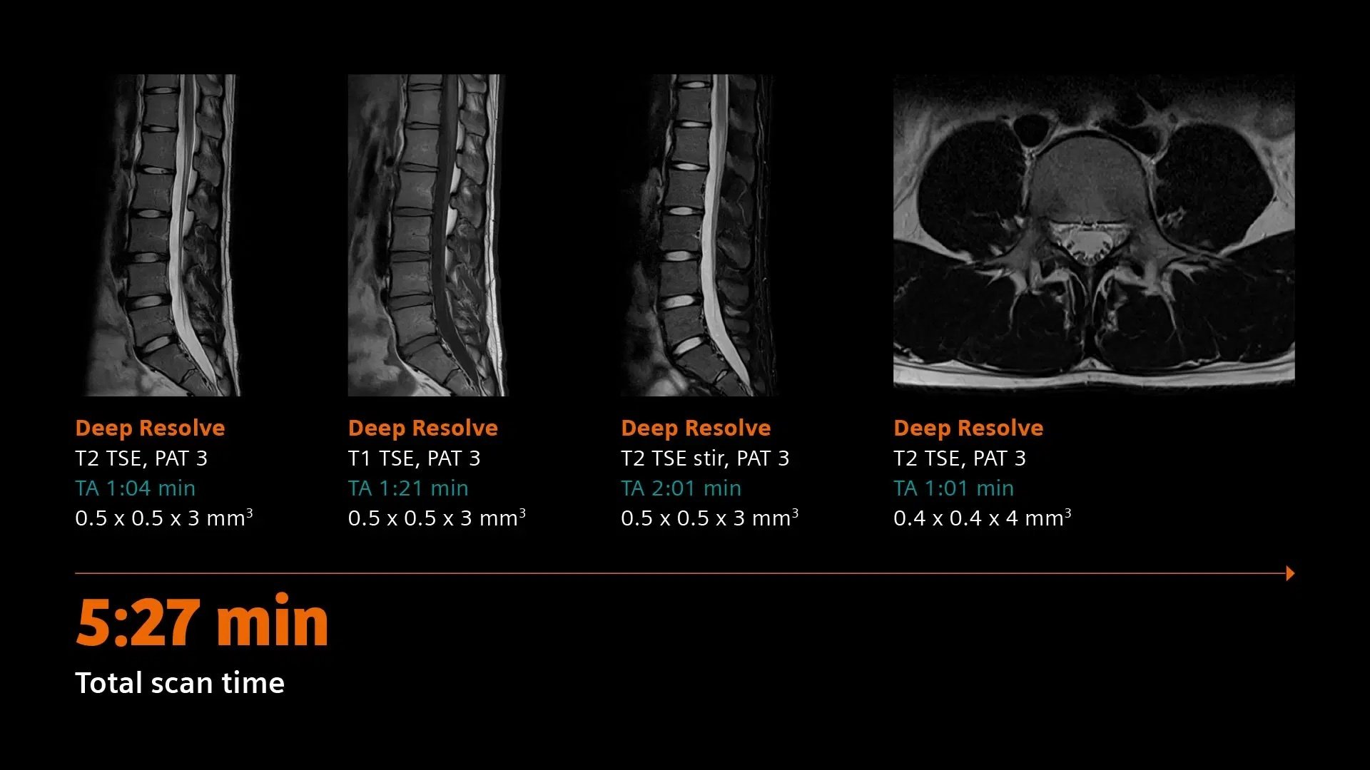 siemens-healthineers_DI_MRI_MAGNETOM-Flow_04_L-Spine-under-6-minutes