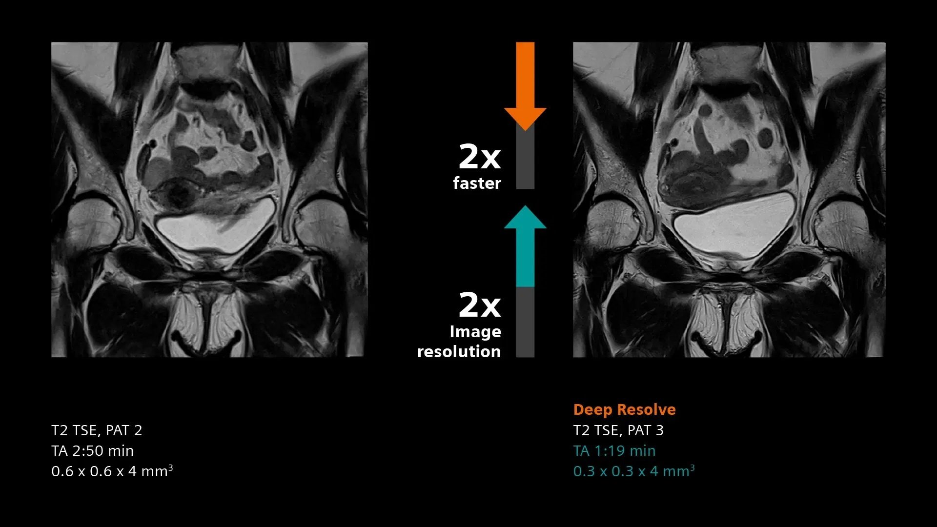 siemens-healthineers_DI_MRI_MAGNETOM-Flow_07_pelvis-fast-high-resolution