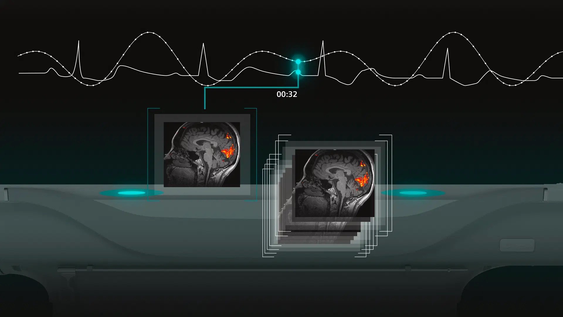 siemens-healthineers_Magnetom-CimaX_Physiologging_1920x1080px
