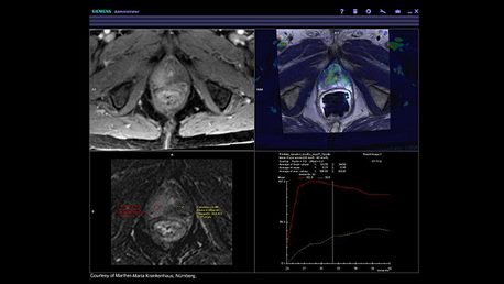 siemens_mri_prostate-mri_image_syngo-mr-general-engine