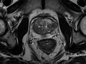 siemens_mri_prostate-mri_image