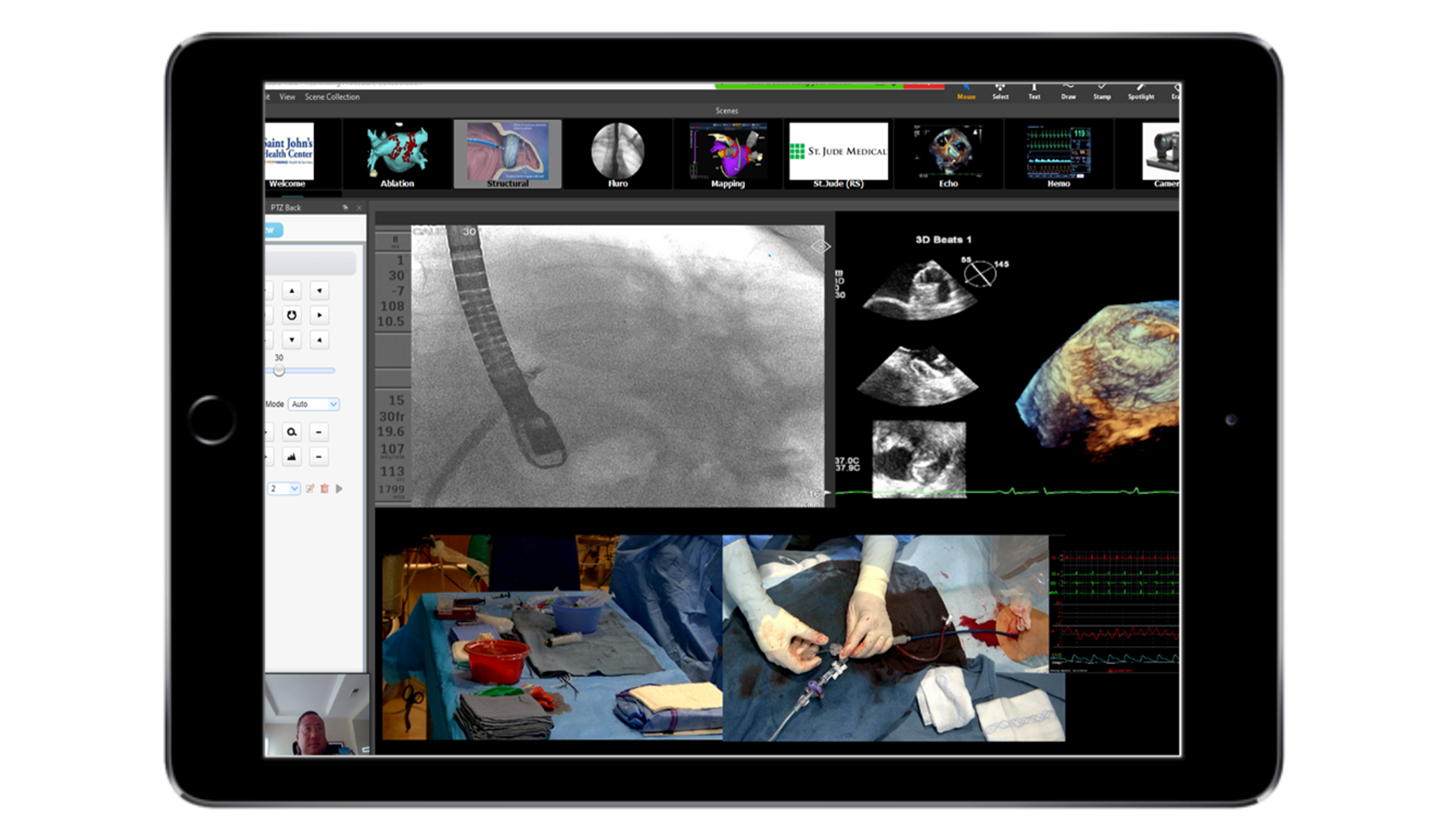 Remote Collaboration