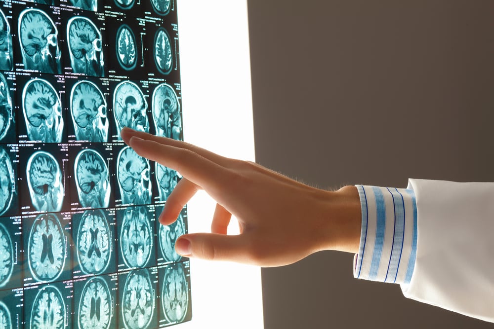 Close-up image of doctors hand pointing at x-ray results-3