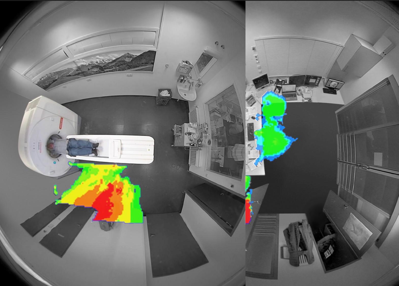 CT-scan-machine_SOMATOM-go_Mobile-Workflow_heatmaps2